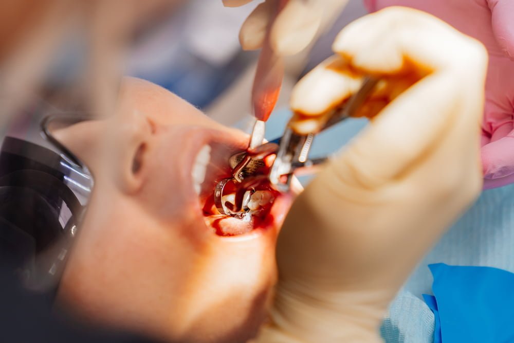 Como evitar cáries nos dentes? 2 Depositphotos 534323570 S