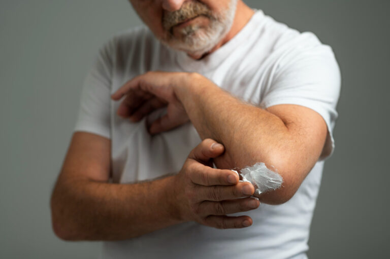 Como hidratar os cotovelos secos? 5 creme para hidratar os cotovelos secos